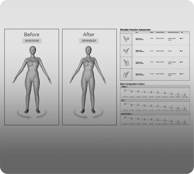 3d Körperscanner, 3d Body Scanner, 3d körperanalyse